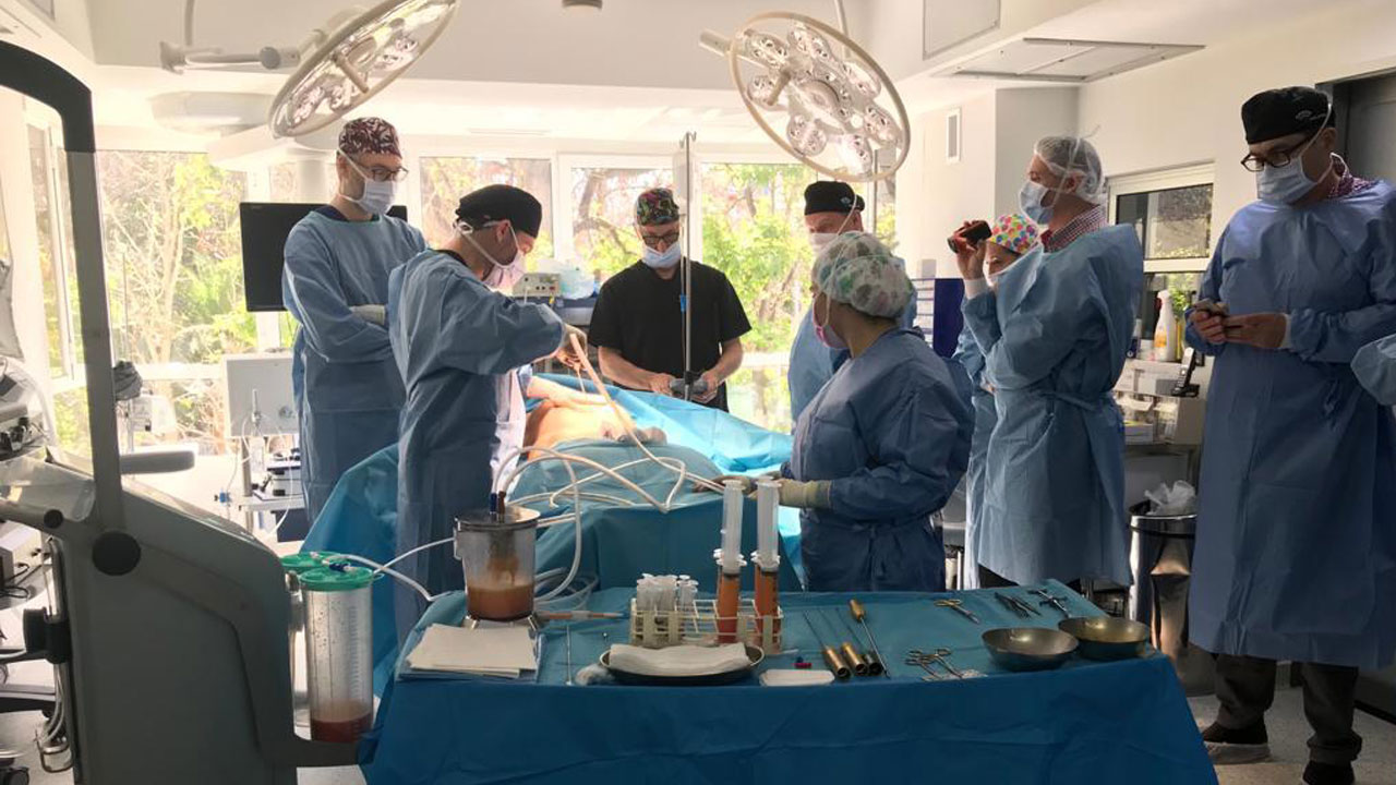 body-jet Liposucción por chorro de agua Workshop 2019 img01